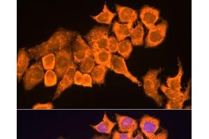 Immunofluorescence analysis of HeLa cells using RPL23 Polyclonal Antibody at dilution of 1:100. (RPL23 anticorps)