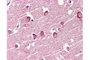 Anti-GPR119 antibody IHC of human brain, cortex. (G Protein-Coupled Receptor 119 anticorps  (Cytoplasmic Domain))