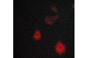 ABIN6269120 staining MCF-7 cells by ICC/IF.