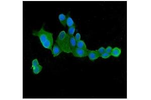 anti-ClpX Caseinolytic Peptidase X (CLPX) (AA 337-574) antibody