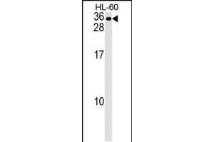 Western blot analysis in HL-60 cell line lysates (35ug/lane). (MS4A7 anticorps  (AA 137-164))