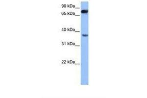 Image no. 1 for anti-Zinc Finger, CCHC Domain Containing 12 (ZCCHC12) (AA 94-143) antibody (ABIN6739394) (ZCCHC12 anticorps  (AA 94-143))