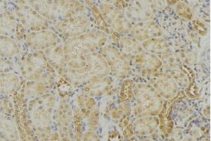 ABIN6279010 at 1/100 staining Mouse kidney tissue by IHC-P. (MRPS18B anticorps  (Internal Region))