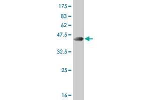Western Blot detection against Immunogen (37. (Retinoic Acid Receptor alpha anticorps  (AA 315-424))