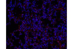 Immunofluorescence analysis of paraffin-embedded mouse Inflammatory lung using Ly6g Polyclonal Antibody at dilution of 1:200. (Ly6g anticorps)