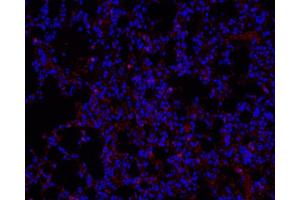 Immunofluorescence analysis of paraffin-embedded mouse Inflammatory lung using Ly6g Polyclonal Antibody at dilution of 1:200. (Ly6g anticorps)