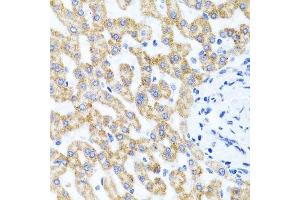 Immunohistochemistry of paraffin-embedded human liver injury using RIPK4 antibody.