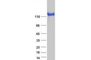 Validation with Western Blot