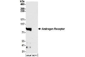 Western Blotting (WB) image for anti-Androgen Receptor (AR) (AA 1-50) antibody (ABIN7454995)