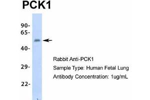 Host:  Rabbit  Target Name:  PCK1  Sample Type:  Human Fetal Lung  Antibody Dilution:  1.