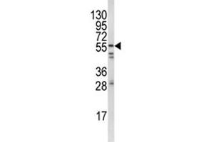Western blot analysis of FYN antibody and HeLa lysate.