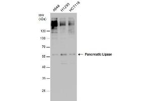 WB Image Pancreatic Lipase antibody detects Pancreatic Lipase protein by western blot analysis. (PNLIP anticorps)