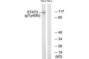 Western blot analysis of extracts from HeLa cells treated with IFN 2500U/ml 30', using STAT2 (Phospho-Tyr690) Antibody. (STAT2 anticorps  (pTyr690))