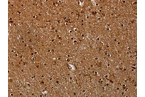 The image on the left is immunohistochemistry of paraffin-embedded Human brain tissue using ABIN7191558(MYBBP1A Antibody) at dilution 1/40, on the right is treated with synthetic peptide. (MYBBP1A anticorps)