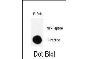 Dot blot analysis of Phospho-CRK-S41 polyclonal antibody (ABIN389702 and ABIN2837929) on nitrocellulose membrane. (Crk anticorps  (pSer41))
