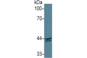 Rabbit Capture antibody from the kit in WB with Positive Control: Sample Human MCF7 cell lysate.