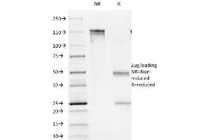 SDS-PAGE Analysis Purified CD1b Mouse Monoclonal Antibody (100-1A5). (CD1b anticorps)