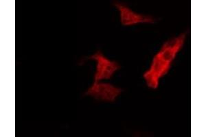 ABIN6274405 staining HepG2 by IF/ICC. (MARK2 anticorps  (Internal Region))