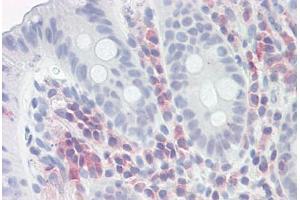 Image no. 2 for anti-Proteasome (Prosome, Macropain) Activator Subunit 1 (PA28 Alpha) (PSME1) (AA 72-121) antibody (ABIN6749766)