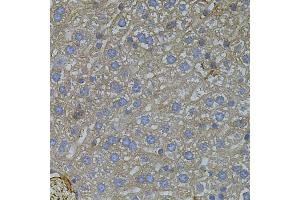 Immunohistochemistry of paraffin-embedded mouse liver using VEGFC antibody (ABIN5971381) (40x lens). (VEGFC anticorps)