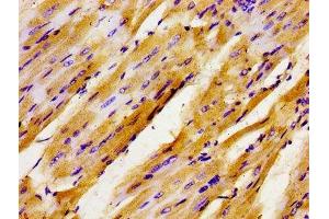 Immunohistochemistry of paraffin-embedded human heart tissue using ABIN7153789 at dilution of 1:100