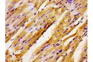 Immunohistochemistry of paraffin-embedded human heart tissue using ABIN7153789 at dilution of 1:100 (GTF2IRD1 anticorps  (AA 436-560))