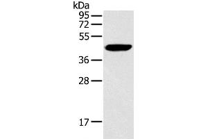 Western Blot analysis of Hela cell using RAD51 Polyclonal Antibody at dilution of 1:200 (RAD51 anticorps)
