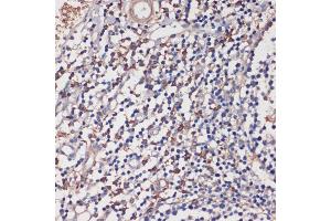 Immunohistochemistry of paraffin-embedded human tonsil using TLR5 antibody (ABIN3022438, ABIN3022439, ABIN3022440 and ABIN6218820) at dilution of 1:100 (40x lens). (TLR5 anticorps  (AA 714-858))
