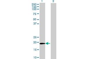 Western Blot analysis of ZFAND1 expression in transfected 293T cell line by ZFAND1 MaxPab polyclonal antibody. (ZFAND1 anticorps  (AA 1-161))