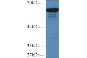 Detection of PKM2 in Human HepG2 cell lysate using Polyclonal Antibody to Pyruvate kinase isozymes M2 (PKM2) (PKM2 anticorps  (AA 141-248))