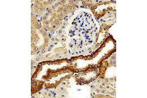 Immunohistochemical analysis of paraffin-embedded M. (FXYD6 anticorps  (C-Term))