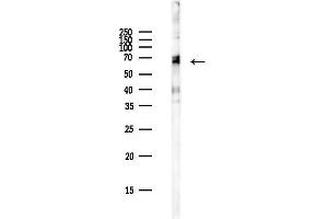 anti-Kelch-Like 26 (KLHL26) antibody