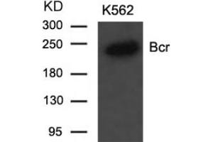Image no. 2 for anti-Breakpoint Cluster Region (BCR) (Tyr177) antibody (ABIN197420) (BCR anticorps  (Tyr177))