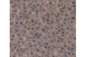 IHC-P analysis of liver tissue, with DAB staining. (NR1I3 anticorps  (AA 1-247))