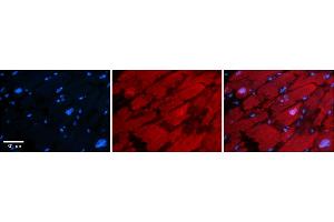 Rabbit Anti-HDAC6 Antibody    Formalin Fixed Paraffin Embedded Tissue: Human Adult heart  Observed Staining: Cytoplasmic,Nuclear Primary Antibody Concentration: 1:600 Secondary Antibody: Donkey anti-Rabbit-Cy2/3 Secondary Antibody Concentration: 1:200 Magnification: 20X Exposure Time: 0. (HDAC6 anticorps  (N-Term))