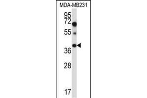 PTPLA Antibody (N-term) (ABIN657409 and ABIN2846449) western blot analysis in MDA-M cell line lysates (35 μg/lane). (PTPLA anticorps  (N-Term))