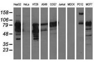 Image no. 4 for anti-phosphoinositide-3-Kinase Adaptor Protein 1 (PIK3AP1) antibody (ABIN1496828)