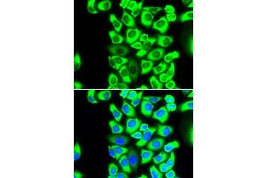 Immunofluorescence analysis of MCF-7 cells using RPS3A antibody (ABIN5973489). (RPS3A anticorps)