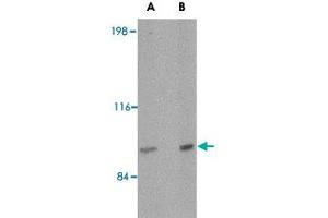 Western blot analysis of SATB2 in mouse brain tissue lysate with SATB2 polyclonal antibody  at (A) 2 and (B) 4 ug/mL . (SATB2 anticorps  (N-Term))
