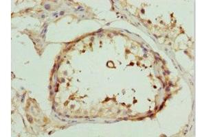 Immunohistochemistry of paraffin-embedded human testis tissue using ABIN7149547 at dilution of 1:100