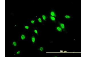 Immunofluorescence of monoclonal antibody to C17orf75 on HeLa cell. (C17orf75 anticorps  (AA 1-396))