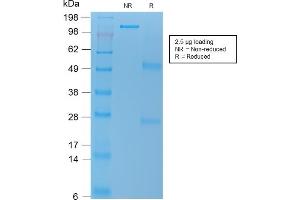 SDS-PAGE Analysis Purified VEGI Mouse Recombinant Monoclonal Antibody (rVEGI /1283). (Recombinant TNFSF15 anticorps)