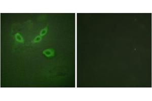 Immunofluorescence analysis of HeLa cells, using TUSC5 antibody. (TUSC5 anticorps  (N-Term))