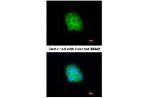 ICC/IF Image Immunofluorescence analysis of methanol-fixed A431, using Amisyn, antibody at 1:200 dilution. (STXBP6 anticorps  (N-Term))