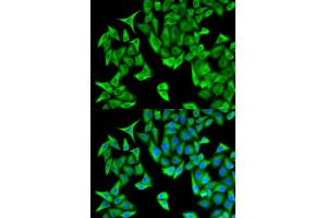 Immunofluorescence analysis of HeLa cells using PSMD9 antibody (ABIN5973093). (PSMD9 anticorps)
