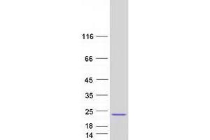 Validation with Western Blot