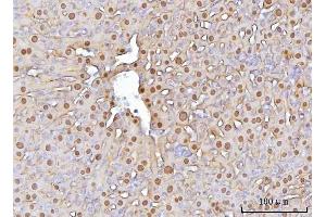 IHC analysis of FAA/FAH using anti-FAA/FAH antibody (ABIN7599291). (FAH anticorps  (AA 1-342))