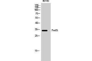 Western Blotting (WB) image for anti-Forkhead Box E1 (Thyroid Transcription Factor 2) (FOXE1) (N-Term) antibody (ABIN3184656) (FOXE1 anticorps  (N-Term))