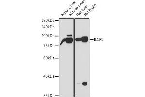 Western blot analysis of extracts of various cell lines, using IL1R1 antibody (ABIN6134083, ABIN6142341, ABIN6142342 and ABIN6221393) at 1:1000 dilution. (IL1R1 anticorps)