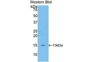 Western Blotting (WB) image for anti-Thymic Stromal Lymphopoietin (TSLP) (AA 75-196) antibody (ABIN1174486) (Thymic Stromal Lymphopoietin anticorps  (AA 75-196))